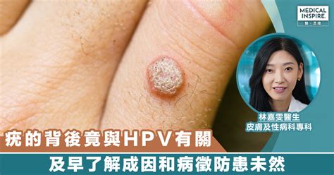 hpv medical inspire