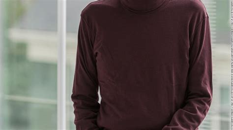 First African American patient receives full face transplant - CNN Video