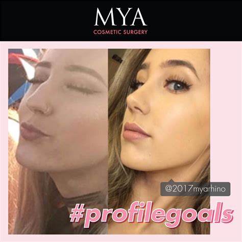 mya cosmetic surgery  twitter profile goals myaselfie