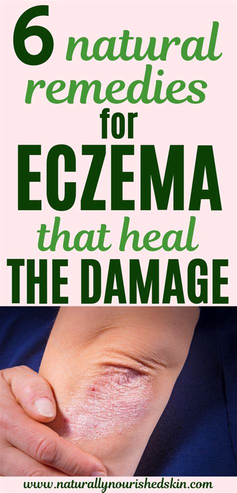 These natural remedies for eczema both heal and repair your skin! # ...