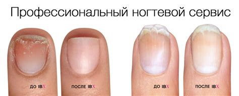 Система востановления ногтей IBX – Вуаля