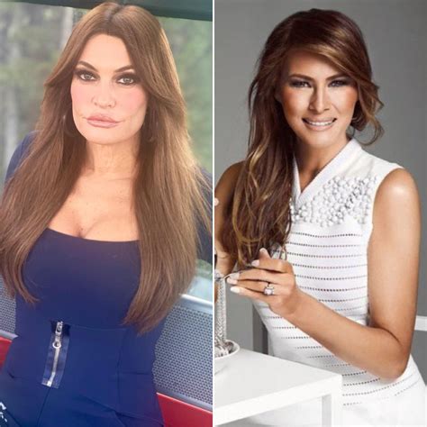 Kimberly Guilfoyle's Plastic Surgery Photos: Before And After ...