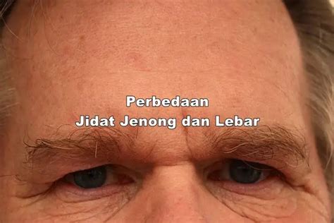 perbedaan jidat jenong  lebar pembedaid