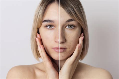 face plastic surgery    surgery