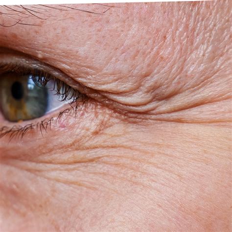 How to Get Rid of Wrinkles: 12 Wrinkle Removing Options | Ro