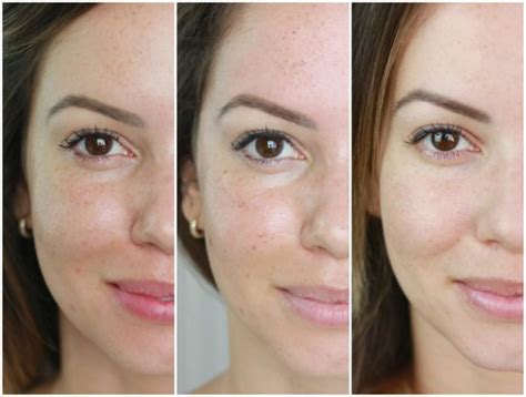 Ácido Kojico Antes E Depois - Creme De Acido Kojico Antes E Depois Ácido Kójico Vitamina C