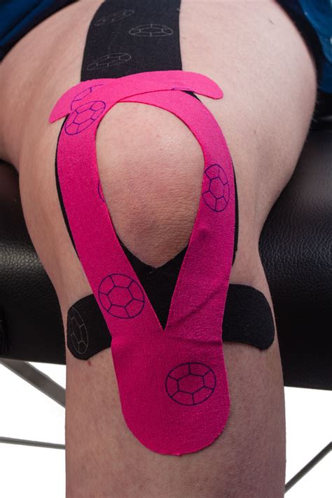 Knee Pain Kinesio Taping – Physical Sports First Aid Blog