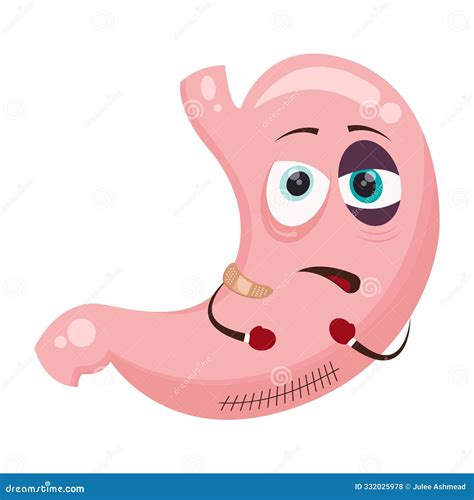 Stomach Banding Isolated. Adjustable Gastric Band. Vector Illustration