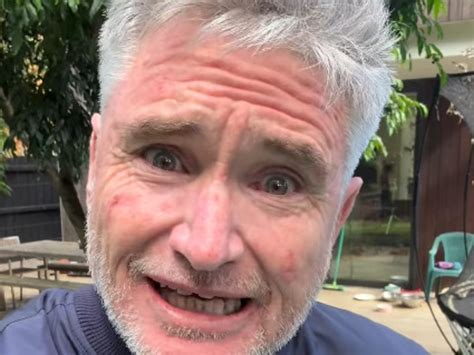 comedian dave hughes tees   player mental health episode