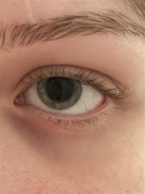 Any idea why my pupils are always so huge? They respond normally to