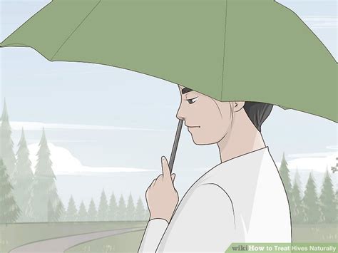 how to treat hives at home