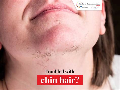 Troubled with chin hair?