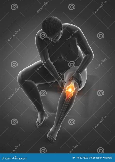 Painful knee joint stock illustration. Illustration of joint - 148227320