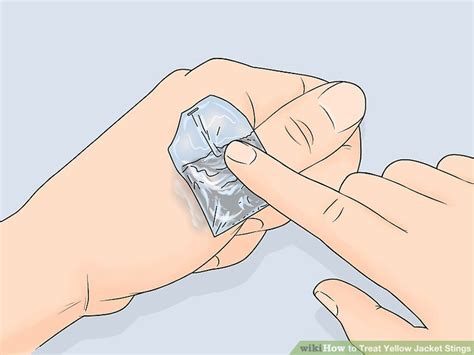 Yellow Jacket Sting Treatment: What to Do for Quick Relief