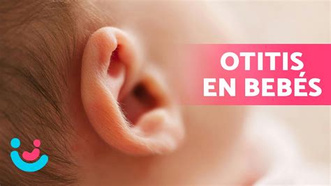 Otites Nos Bebés - OTITIS en BEBÉS 👶🏻👂🏻 | Síntomas, Tratamiento y Cómo Prevenirla - YouTube