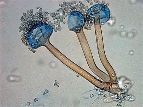 Rhizopus | Mycology | University of Adelaide