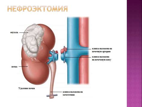 Основы урологии - презентация онлайн