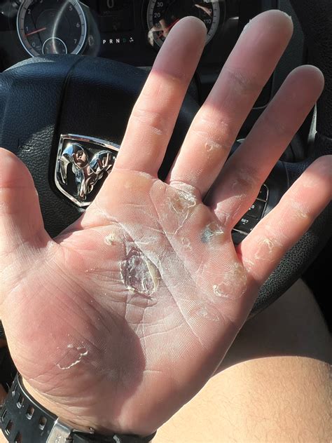 MAINTAIN CALLUSES, ELEVATE PERFORMANCE – SandBar Hand Care