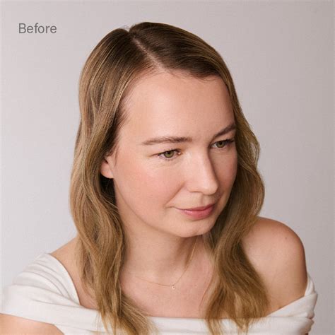 Thinning Hair Solutions | 100% Remy