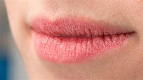 natural ingredients  treat dry  chapped lips