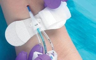 PICC and CVC Catheter | New England Medical Specialties