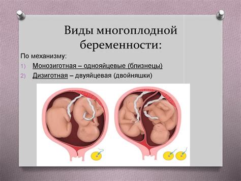 Cестринский уход за новорождёнными при многоплодной беременности ...
