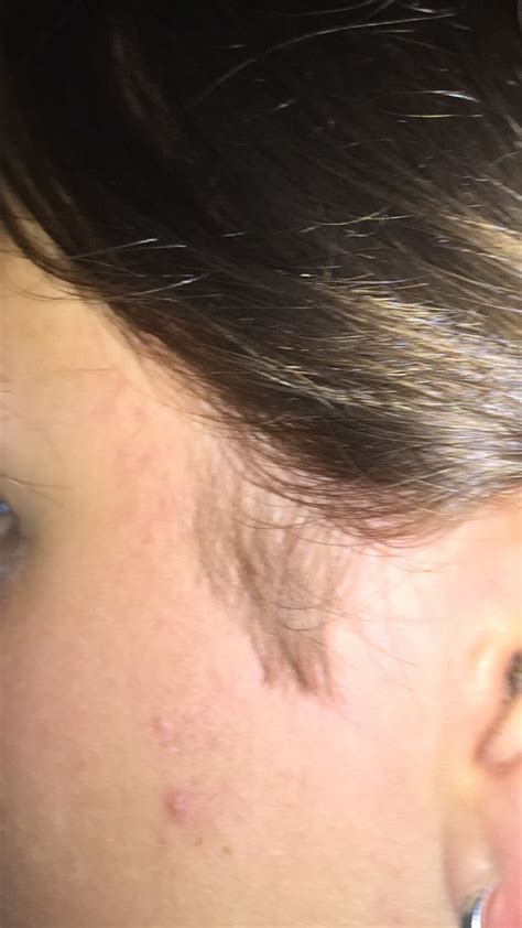 Advice for Women Removing Sideburns? | ThriftyFun