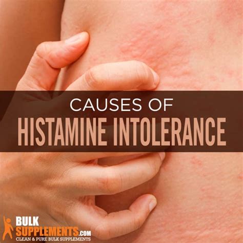 Histamine Intolerance: Signs, Causes & Treatment