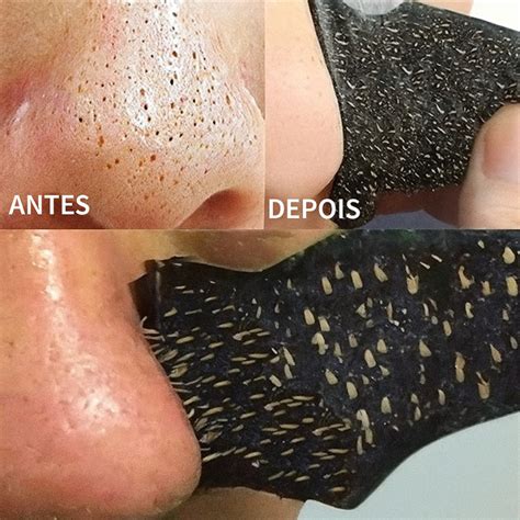 Produtos Para Cravos No Nariz - Adesivo para remover cravos no nariz com 5/10/30/50 unidades/Fita para ...