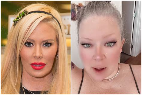 Jen Psaki's Plastic Surgery Journey: A Timeline Of Transformations Image 10