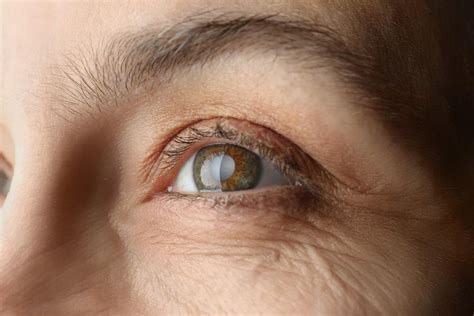 5 Eye Conditions Caused by Sun Damage: Stephen Khachikian, MD ...