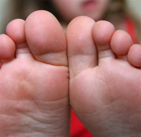 foot disorders foot clinic  south carolina