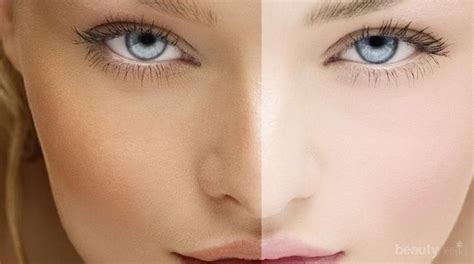 melakukan pemutihan kulit     benar melakukan bleaching