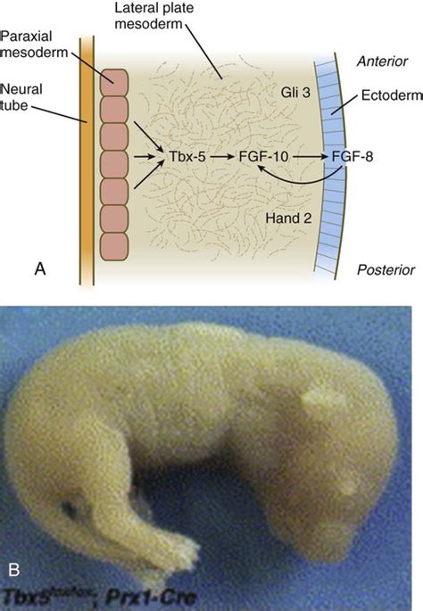 Limb Development | Basicmedical Key