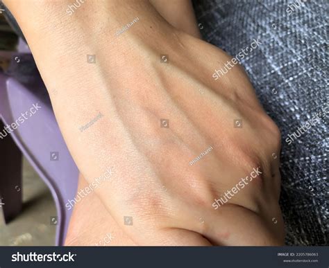 Woman Back Hand Blood Veins Hand Stock Photo 2205786063 | Shutterstock