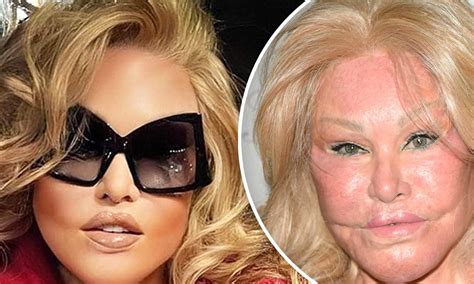 The Enigmatic Life of Jocelyn Wildenstein: From Fame to Financial