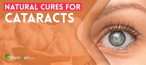 9 Effective Natural Cures for Cataracts to Relieve Its Symptoms [Naturally]