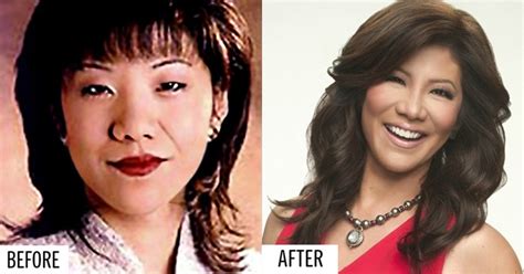 Julie Chen Plastic Surgery Before And After Photos Plastic Surgery ...