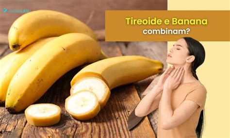 Quem Tem Dermatite Pode Comer Banana - Pode Comer Banana Com Febre - RETOEDU