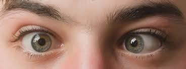effective homeopathic remedies  common eye problems