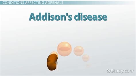 Adrenal Gland Disorders - Lesson | Study.com