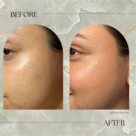 THE FACE BAR - Updated June 2024 - Request an Appointment - Los Angeles ...