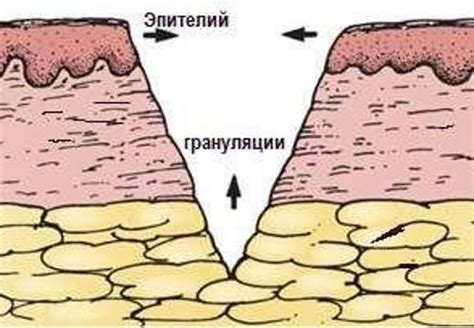Что такое грануляция ран и как ускорить ее без вреда?