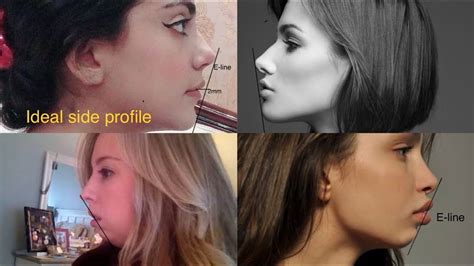 What Is Considered A Good Side Profile at Michael Thornton blog
