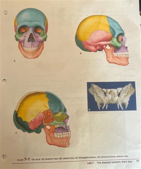 solved orbit   eye  bones   orbit   eye cheggcom