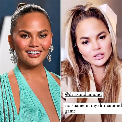 Hottest Women Celebrity's Shocking Transformation: Before & After Pics Image 11