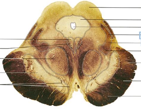 midbrain labels quiz