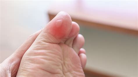 20 common hiking mistakes and how to avoid them