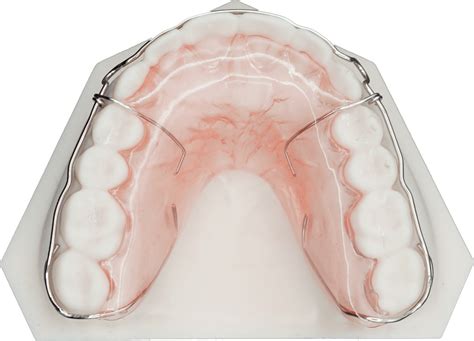 Hawley Retainer Upper - Protec Dental