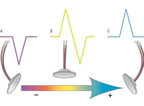 lead comparison cardiac sciences manitoba